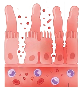 Intestino permeável